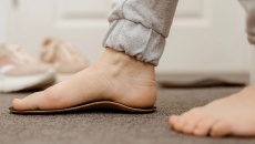 Nguy cơ sức khỏe đi cùng đôi bàn chân bẹt
