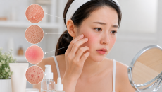 Cách phục hồi hàng rào bảo vệ da trong 4 tuần