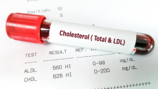 Ăn uống bình thường vẫn tăng cholesterol máu: Nguyên nhân từ đâu?