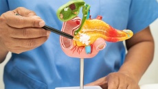 Làm thế nào để nhận ra dấu hiệu cảnh báo sỏi mật giai đoạn đầu?