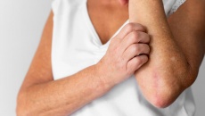 Người bệnh đái tháo đường bị ngứa có cách gì cải thiện được không?