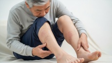 Đái tháo đường: Bị xơ vữa 2 chân, đau châm chích làm sao cải thiện?