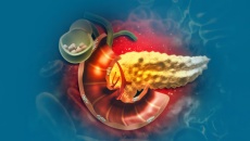 Sau ERCP lấy sỏi mật 1 tuần, dùng TPBVSK Kim Đởm Khang được không?