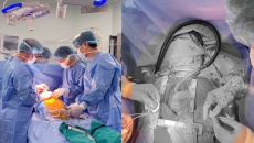 Việt Nam lần đầu cấy ghép thành công thiết bị hỗ trợ tim thế hệ mới CorHeart 6 