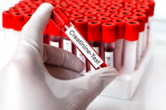 Làm thế nào để ổn định nồng độ creatinine ở bệnh nhân suy thận?
