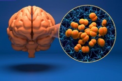 Hà Nội phát hiện ca mắc bệnh não mô cầu thứ 3 trong năm 