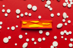 Thói quen tưởng tốt nhưng lại góp phần gây tắc mạch vành