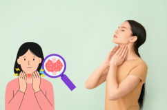 Bướu cổ đơn thuần có đáng lo ngại?