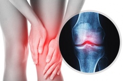Đau xương khớp cảnh báo bệnh gì?