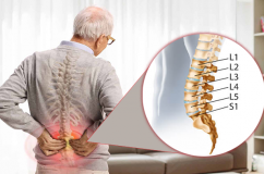 Dấu hiệu nhận biết thoái hóa đốt sống lưng L5 S1 không nên bỏ qua