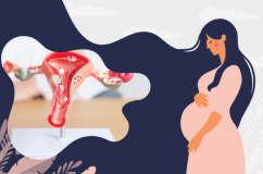 Bị nhân xơ tử cung có thai được không?