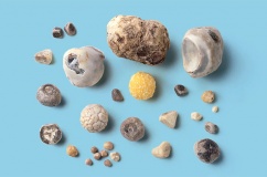 Sỏi mật 7mm: Dùng TPBVSK Kim Đởm Khang được không?