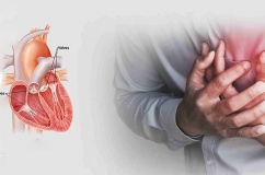 Hẹp van tim do thấp tim: Nguy cơ tiềm ẩn ở người trẻ