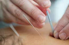 Châm cứu giúp bệnh nhân ung thư vú vượt qua chứng 'sương mù não'