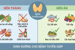 Người bị bệnh tuyến giáp nên kiêng ăn gì?