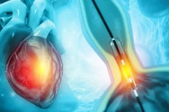 Hẹp mạch vành sau khi điều trị có tự hồi phục hoàn toàn không?