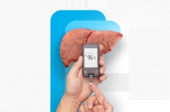 Người bệnh đái tháo đường bị gan nhiễm mỡ cần điều trị thế nào?