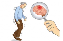 Bị run tay do thoái hóa chất trắng có dùng TPBVSK Vương Lão Kiện được không?