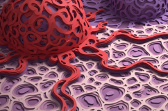 Biểu hiện của khối u ác tính như thế nào?