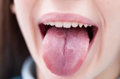 Thủ phạm “quen mặt” tăng nguy cơ ung thư miệng lên 50%