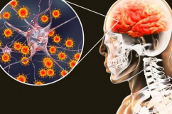 Bệnh viêm não mô cầu diễn biến phức tạp, Bộ Y tế cảnh báo