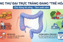 Khi nào người trẻ cần đi tầm soát ung thư đại trực tràng?
