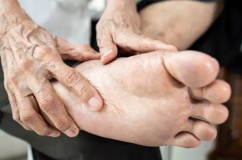 Làm sao phòng ngừa biến chứng bàn chân cho người bệnh đái tháo đường?