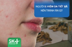 Podcast: Người bị viêm da tiết bã nên tránh ăn gì?