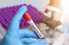 Tại sao chỉ số creatinin lúc tăng lúc giảm?