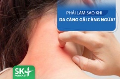 Podcast: Da bị ngứa càng gãi càng ngứa - Làm thế nào?