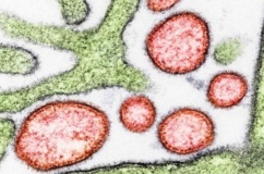 Nhật Bản: Chuẩn bị thử nghiệm lâm sàng vaccine ngừa virus Nipah