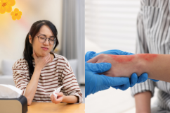 Infographic: Những bước sơ cứu cơ bản tại nhà ngày Tết