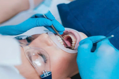 WHO ban hành hướng dẫn mới về phòng và điều trị sâu răng