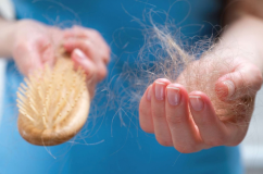 Nhận biết sớm dấu hiệu rụng tóc và cách hạn chế