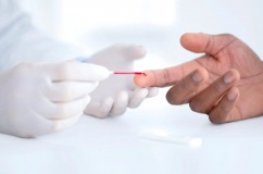 Hướng dẫn mới: Theo dõi chỉ số cholesterol từ khi còn trẻ