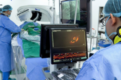 Điều trị vôi hóa động mạch vành bằng sóng xung kích