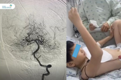 Bé trai 10 tuổi suýt liệt nửa người sau khi đi chơi cầu lông