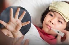 Bệnh thủy đậu là gì và cách điều trị ra sao? 