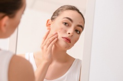 Infographic: Tại sao người trưởng thành vẫn có thể bị mụn?