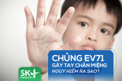 Podcast: Chủng virus tay chân miệng EV71 nguy hiểm ra sao?