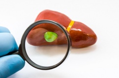 Polyp túi mật có nguy hiểm không?