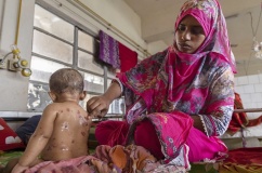Bangladesh: Gần 100 trẻ em tử vong nghi do dịch sởi bùng phát