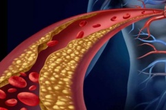 Rối loạn lipid máu có chữa khỏi được không?