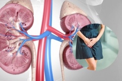 Thói quen chị em nên bỏ để bảo vệ đường tiết niệu