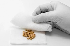 Vì sao sỏi mật 11mm kèm mỡ máu cao lại gây đầy hơi, khó tiêu?