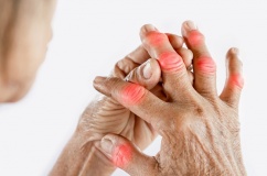 6 bí quyết kiểm soát acid uric, ngăn chặn cơn đau gout cấp