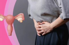 Giải pháp giúp kiểm soát u nang buồng trứng an toàn 