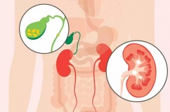 Sỏi mật có gây ra các vấn đề về đường tiết niệu không?
