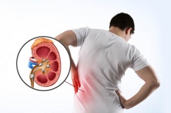 Chế độ ăn uống giúp ngăn sỏi thận tái phát