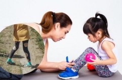 Khớp gối vẹo ngoài: Dáng đi bất thường ở trẻ cha mẹ nên theo dõi